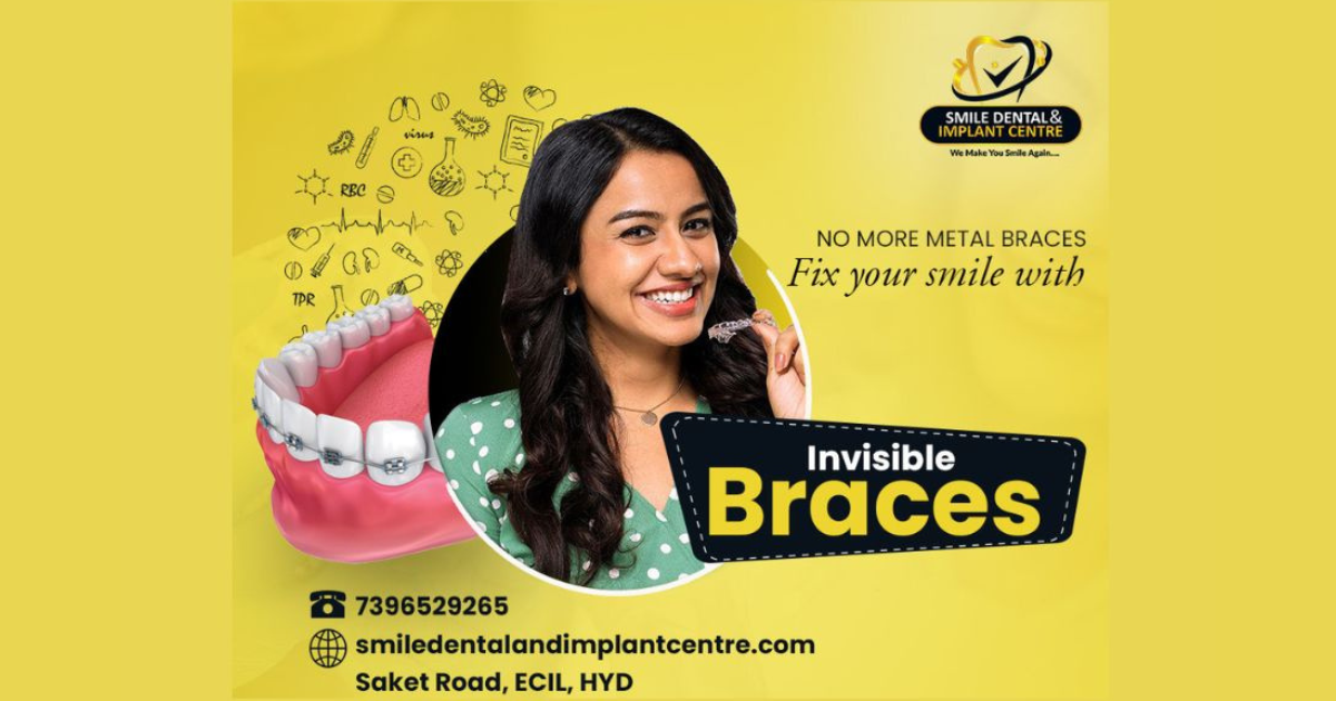 Smile Dental and Implant Centre shared the benefits of Invisible Braces over the Traditional Braces Treatment in a recently held Press Conference